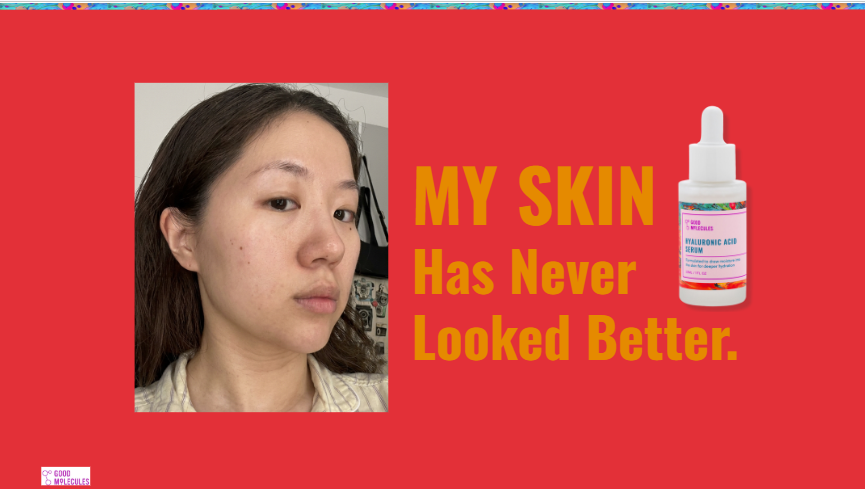 Good Molecules slide: my skin story